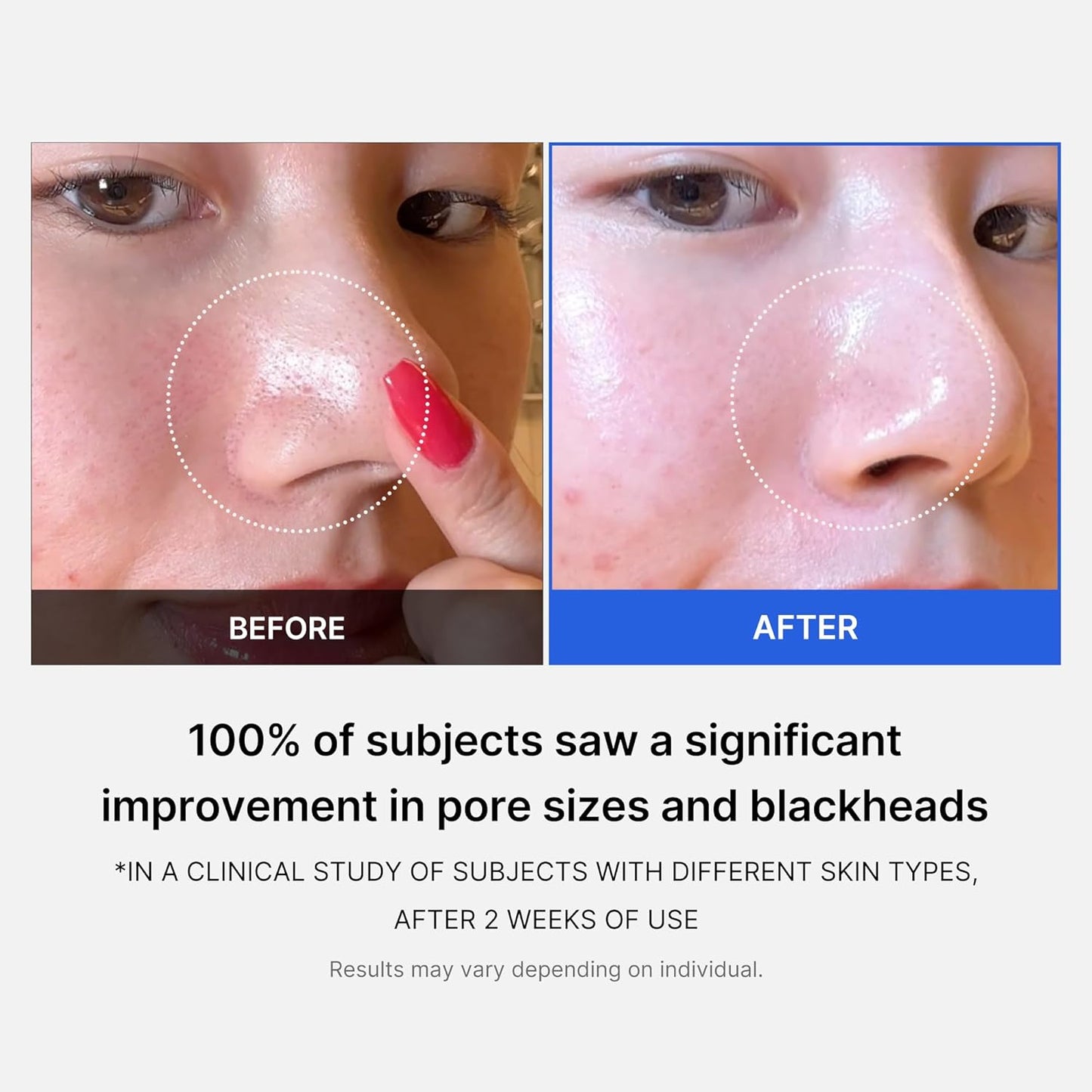 Zero Pore Pads | Medicube