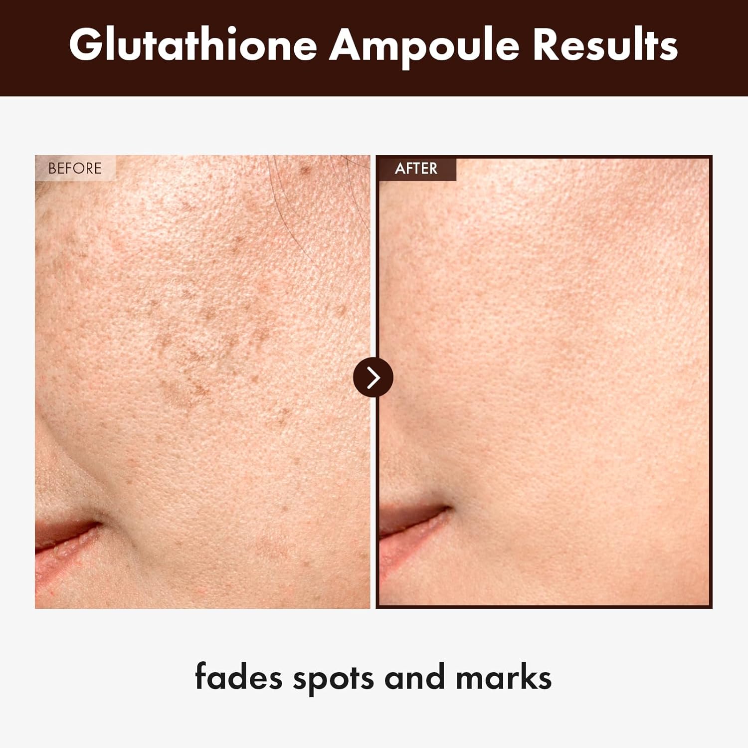 Glutathione Serum | Tosowoong